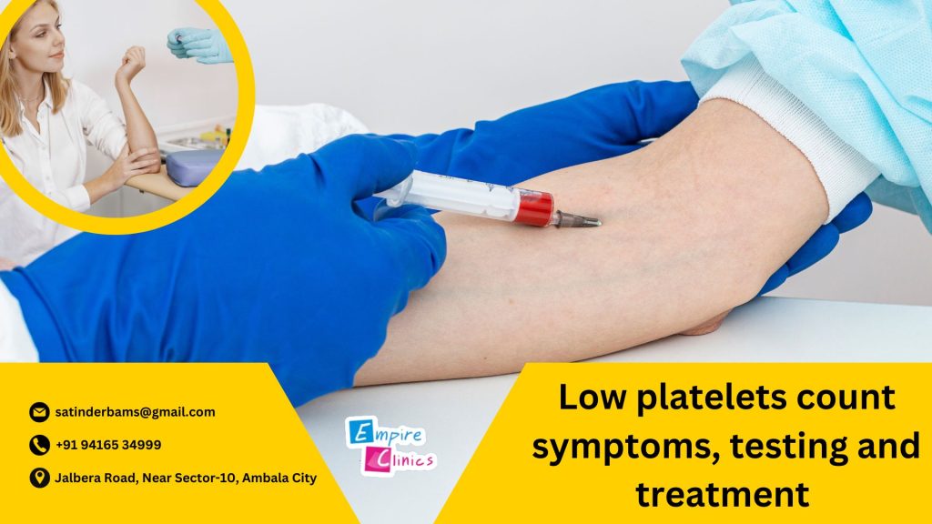 low-platelets-count-symptoms-testing-and-treatment