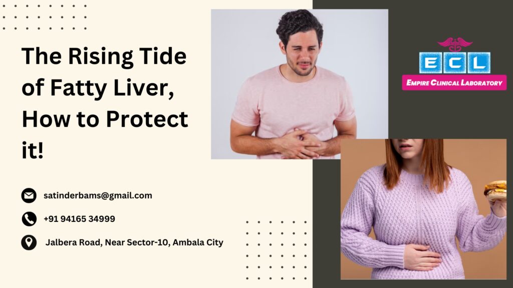 the-rising-tide-of-fatty-liver-how-to-protect-it